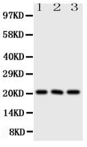 Polyclonal Rabbit anti-Human FGF21 Antibody (aa43-58, WB)