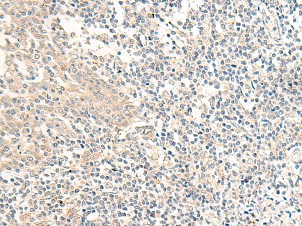 GPR161 Antibody