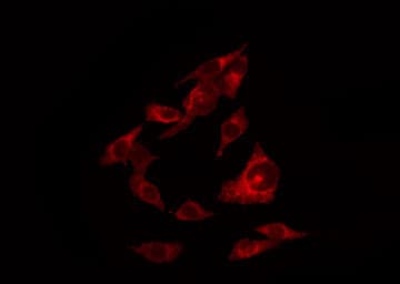 Polyclonal Rabbit anti-Human ERBB4 / HER4 Antibody (phospho-Tyr1284, IHC, IF, WB)