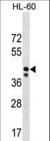 Polyclonal Rabbit anti-Human MRPS31 Antibody (aa219-247, WB)