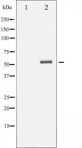 NPY2R Antibody