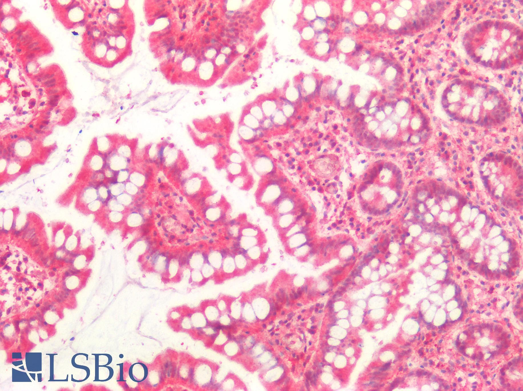 IHC-plus™ CASP10 / Caspase 10 Antibody