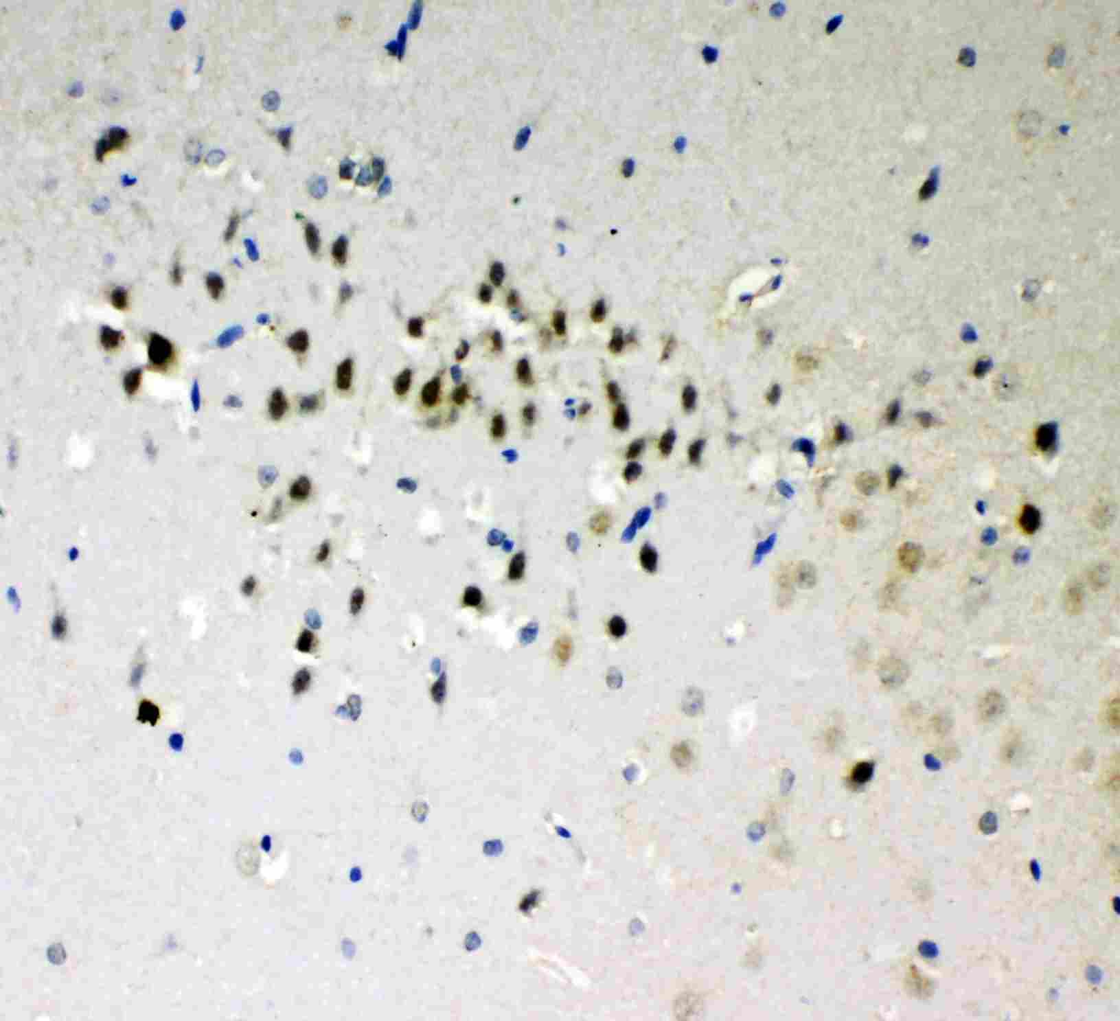 Polyclonal Rabbit anti-Human DDX5 Antibody (aa566-580, IHC, WB)