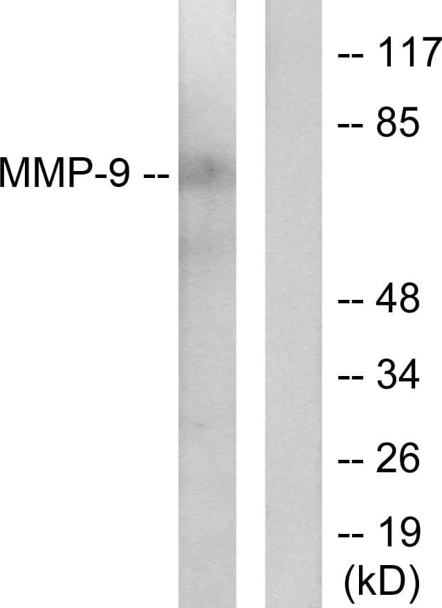 MMP9 / Gelatinase B Antibody (aa651-700)