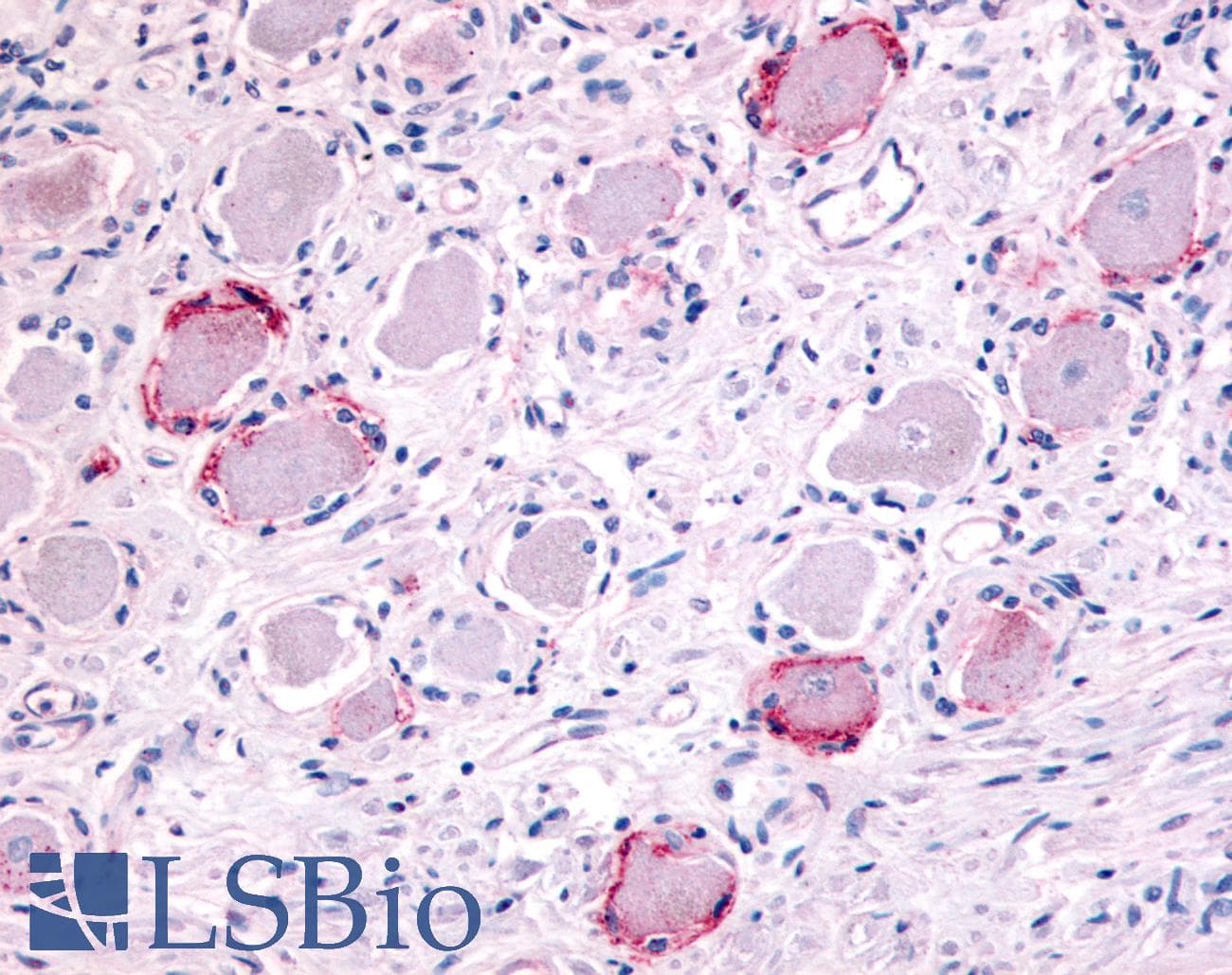 PathPlus™ Polyclonal Rabbit anti-Human TRPA1 Antibody (Internal, IHC, IF)