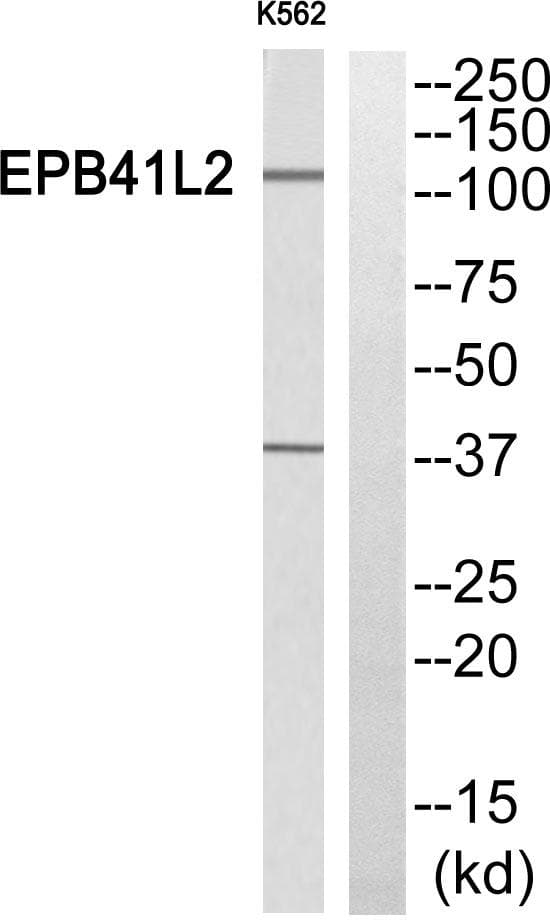 Polyclonal Rabbit anti-Human EPB41L2 Antibody (WB)