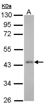 IHC-plus™ Polyclonal Rabbit anti-Human GPR32 Antibody (IHC, WB)
