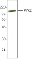 IHC-plus™ PTK2B / PYK2 Antibody (N-Terminus)