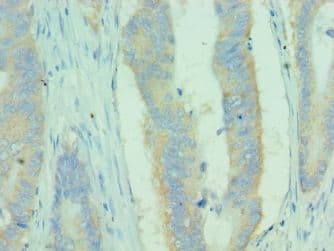 MICA Antibody (aa24-307)