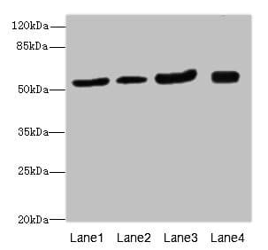 ANTXR2 / CMG2 Antibody