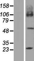 SLC7A7 Protein (Over-Expression Lysate Myc-DDK (Flag))