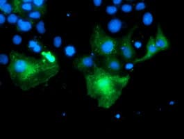 PECR Antibody (clone OTI1F2)