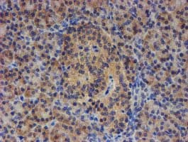 EIF4E2 / IF4e Antibody (clone OTI4E7)