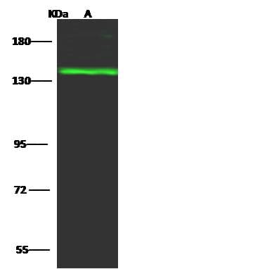 Polyclonal Rabbit anti-Human TTF2 / HuF2 Antibody (Preservative Free, WB)