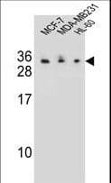 Polyclonal Rabbit anti-Human C1QL4 Antibody (aa1-30, WB)