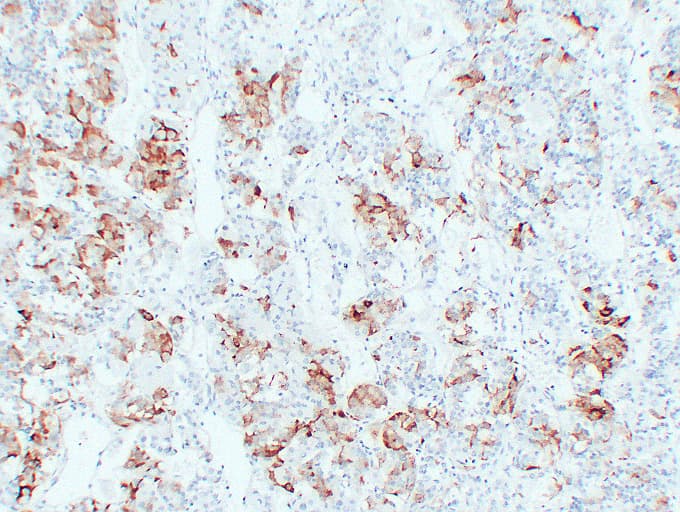 TSHB / TSH-Beta Antibody (clone ABT-TSH)