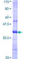 Human CD1C Protein (Recombinant GST, N-terminus)