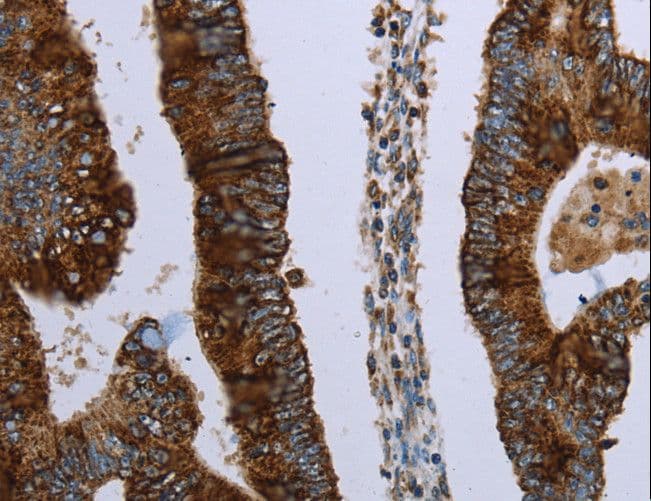 HMGCL Antibody