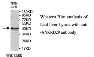 Polyclonal Rabbit anti-Human ANKRD29 Antibody (aa79-299, IHC, WB)