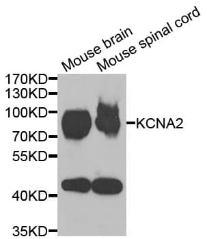 PathPlus™ Polyclonal Rabbit anti-Human KCNA2 / Kv1.2 Antibody (IHC, IF, WB)