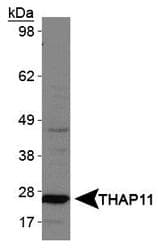 CTG-B45d / THAP11 Antibody