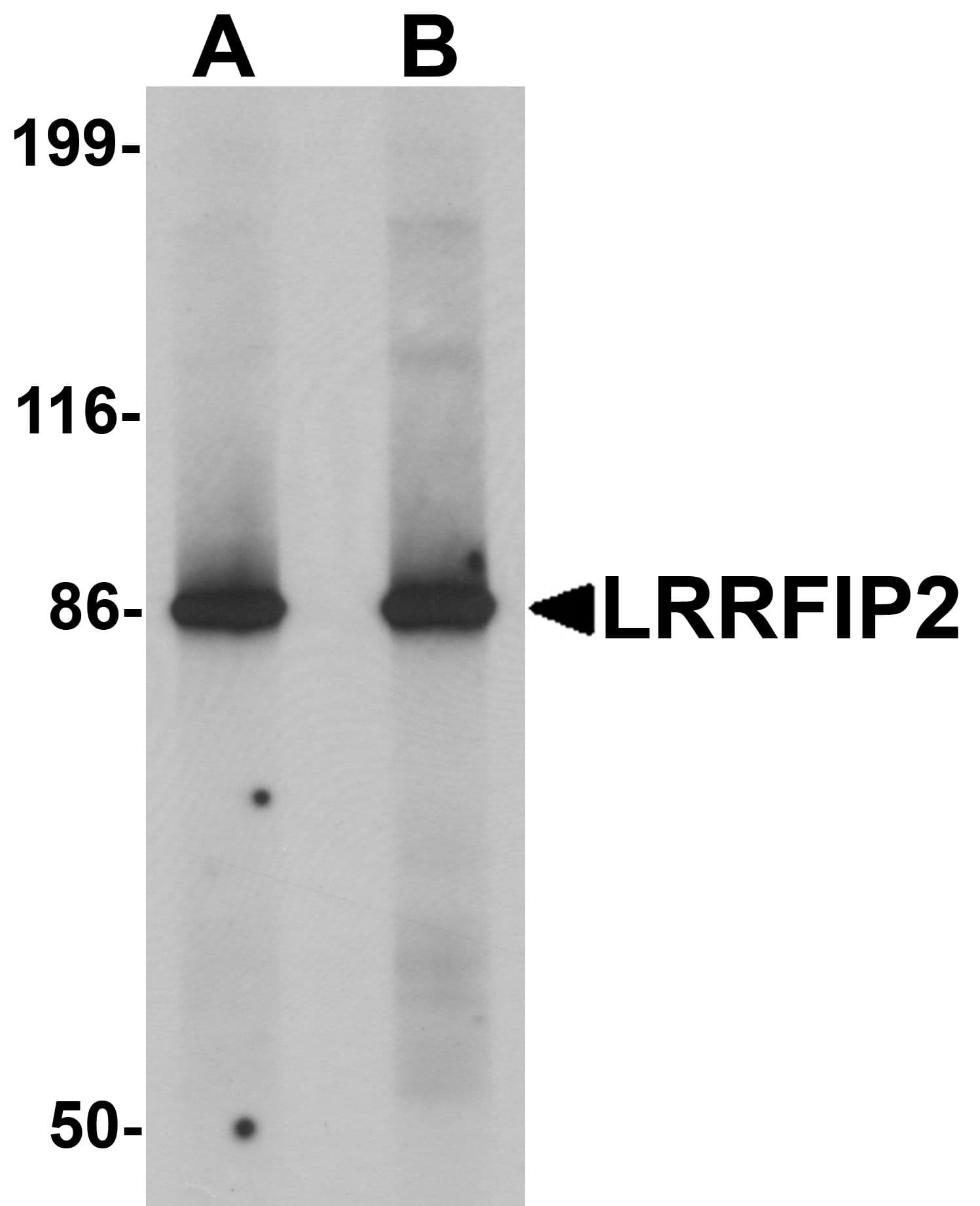 HUFI-2 / LRRFIP2 Antibody