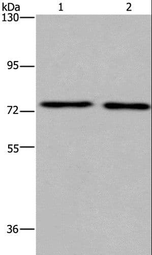 Polyclonal Rabbit anti-Human KCNQ4 Antibody (IHC, WB)