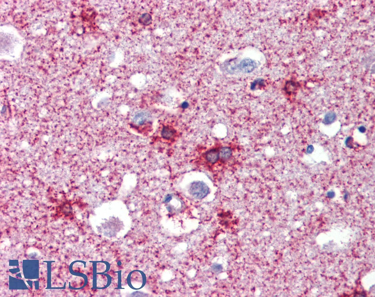 IHC-plus™ Polyclonal Goat anti-Human SEPT2 / Septin 2 Antibody (aa37-49, IHC, WB)