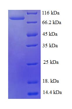 Streptomyces Cholesterol Oxidase Protein (Recombinant GST)