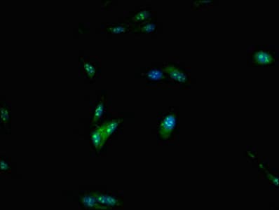 Polyclonal Rabbit anti-Human POLE / POLE1 Antibody (IHC, IF)