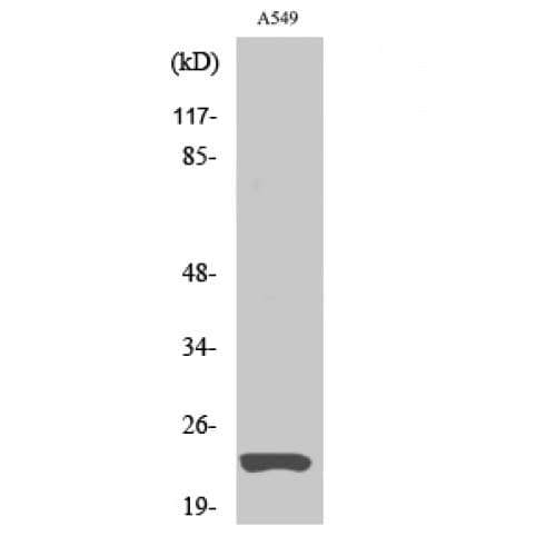 Polyclonal Rabbit anti-Human MAD2L1 / MAD2 Antibody (60-140 aa, Internal, WB)