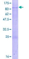 Human ACBD5 Protein (Recombinant GST)