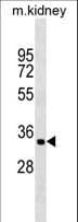 Polyclonal Rabbit anti-Human ZFP36L2 Antibody (aa166-193, WB)