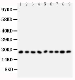Polyclonal Rabbit anti-Human Ribonuclease A / RNASE1 Antibody (aa72-90, WB)