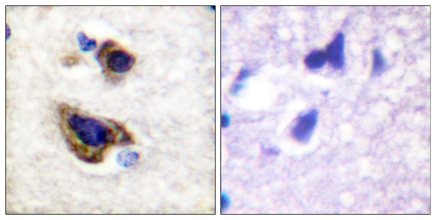GFAP Antibody (p38)