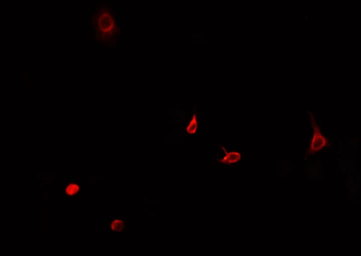 Polyclonal Rabbit anti-Human TP53 / p53 Antibody (IHC, IF, WB)