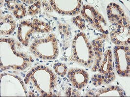 PHF21B Antibody (clone OTI3D1)