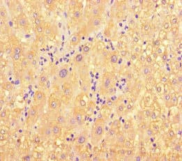 ME1 / Malate Dehydrogenase Antibody