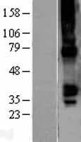 Human GJA5 / CX40 / Connexin 40 Protein (Over-Expression Lysate Myc-DDK (Flag))