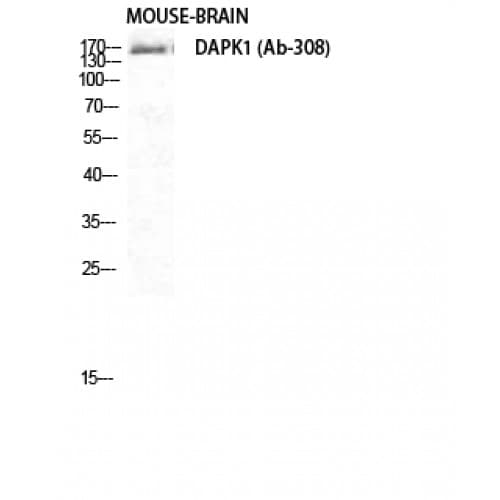DAPK1 / DAP Kinase Antibody (250-330 aa)