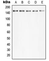 PLCG2 / PLC Gamma 2 Antibody (phospho-Tyr753)