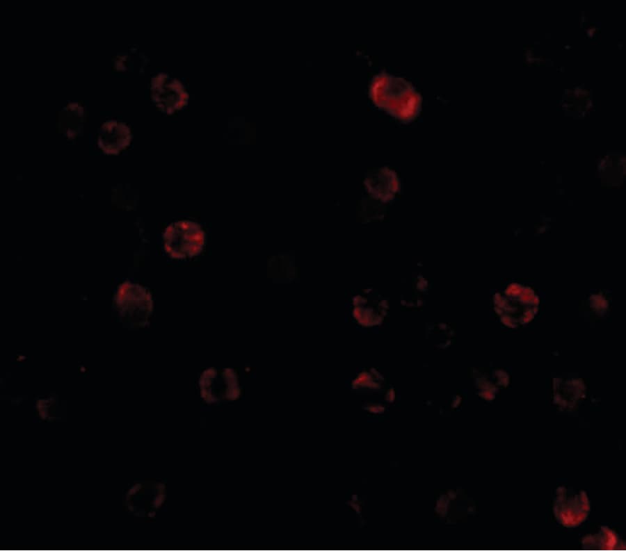Polyclonal Rabbit anti-Human CHUK / IKKA / IKK Alpha Antibody (IF, WB)