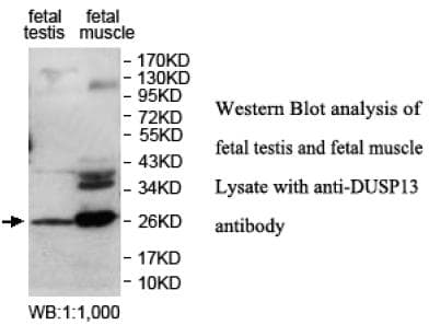 Polyclonal Rabbit anti-Human DUSP13 Antibody (aa2-197, IHC, WB)