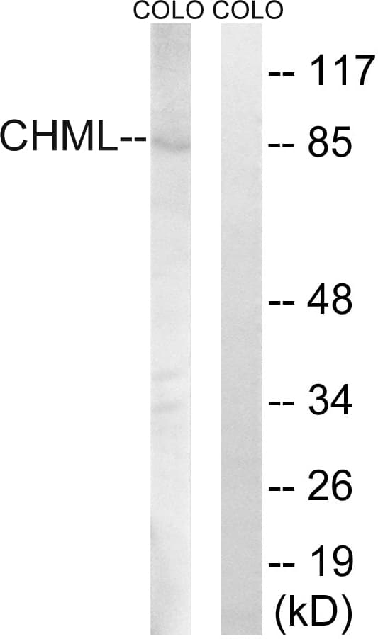 IHC-plus™ Polyclonal Rabbit anti-Human CHML Antibody (aa128-177, IHC, WB)