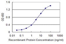 SSTR1 Antibody (clone 1F7)