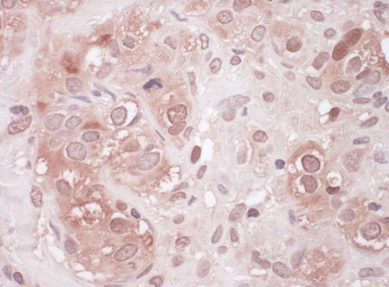 Polyclonal Rabbit anti-Human SQSTM1 Antibody (aa425-440, IHC, WB)