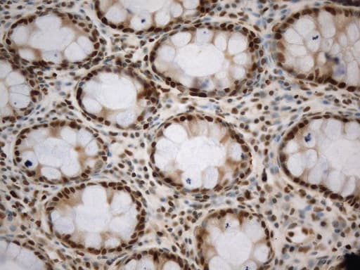 PCNA Antibody (clone UMAB278)
