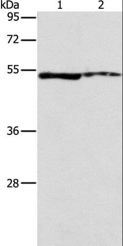 ALDH3A1 Antibody