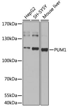 PUM1 Antibody