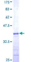 Human TRIM68 Protein (Recombinant GST, N-terminus)